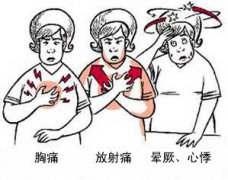 冠心病有哪些癥狀？