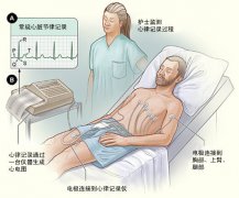 冠心病需要做哪些檢查？