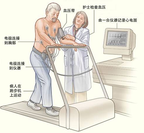 冠心病需要做哪些檢查？(圖3)